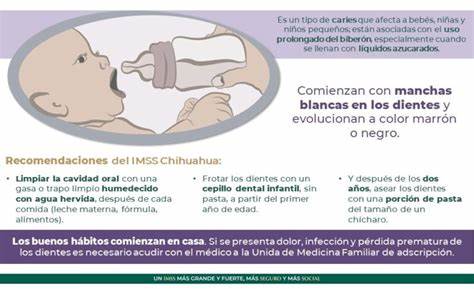 «Caries de biberón» IMSS te explica