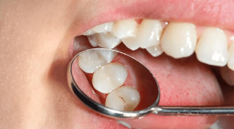 IMSS  exhorta a revisarte padecimientos bucales